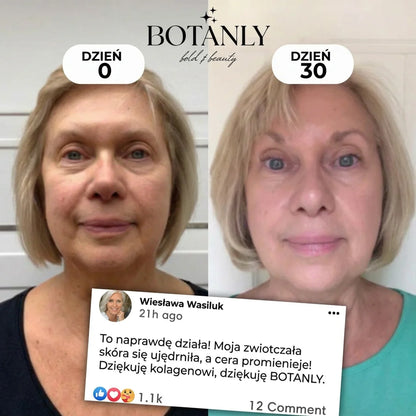 Kolagenowa Maseczka z Kwasem Kojowym Botanly™
