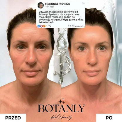 Kolagenowa Maseczka z Kwasem Kojowym Botanly™